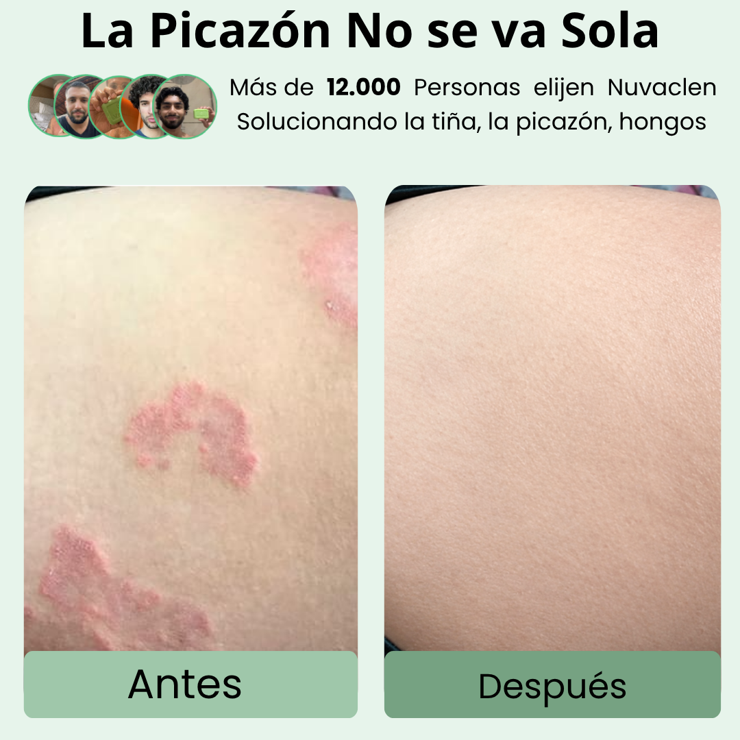 NUVACLEN Clear Skin Defense