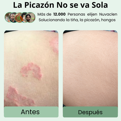 NUVACLEN Clear Skin Defense